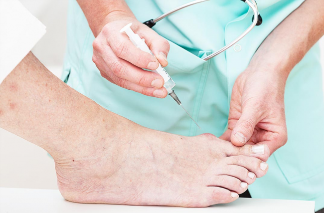 Você sabe quais são os cuidados necessários para a saúde do pé diabético?